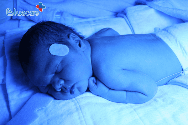Tổn thương mắt nếu chiếu đèn vàng da sai cách
