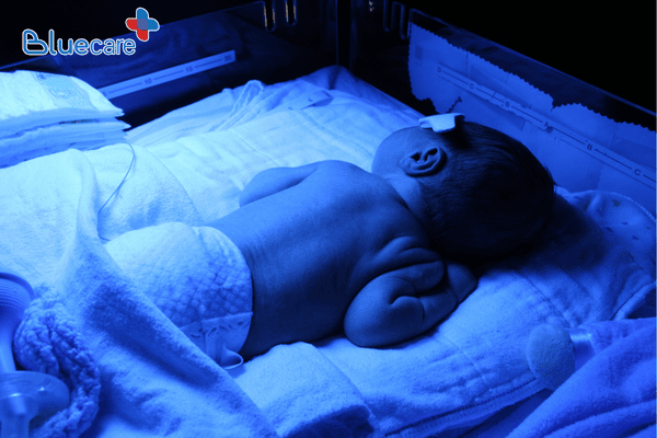 Cách đặt trẻ nằm khi chiếu đèn vàng da