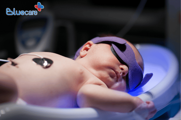 Che kín mắt trẻ khi chiếu đèn vàng da