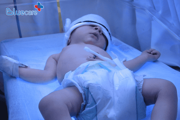 Chiếu đèn vàng da theo chỉ định của bác sĩ