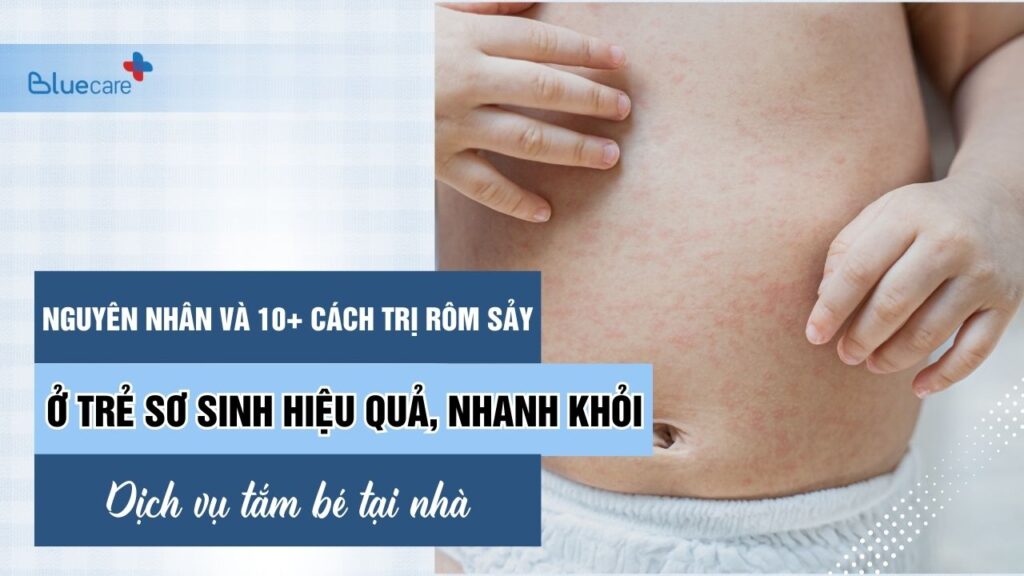 Cách trị rôm sảy ở trẻ sơ sinh