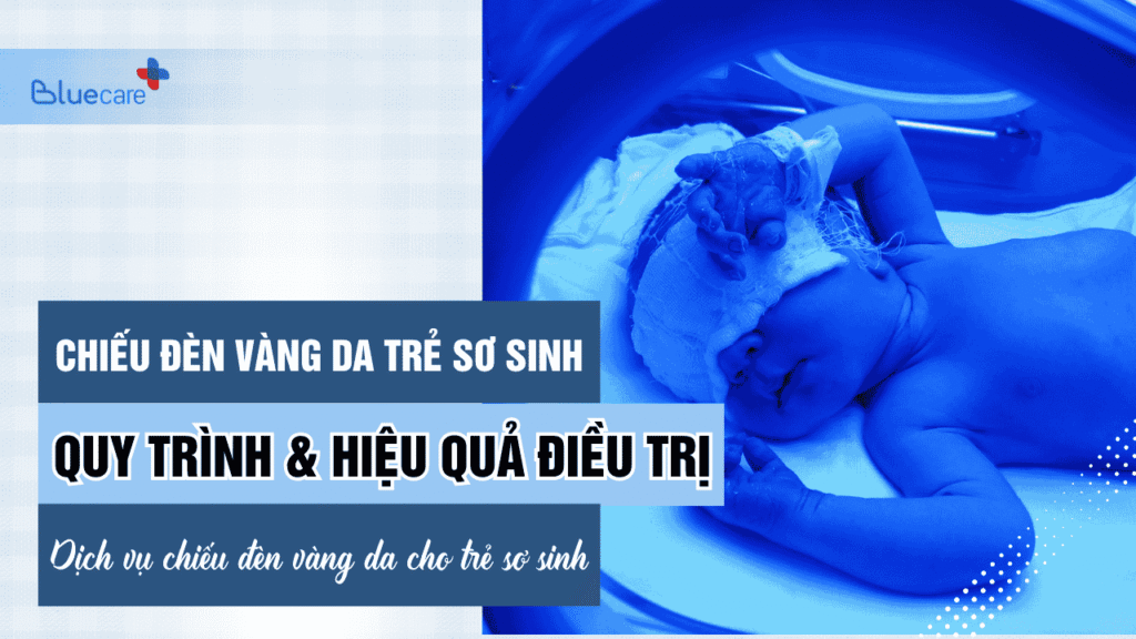 Quy trình chiếu đèn vàng da cho trẻ sơ sinh