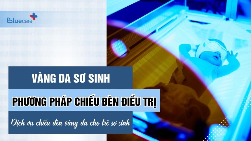 Chiếu đèn điều trị vàng da sơ sinh