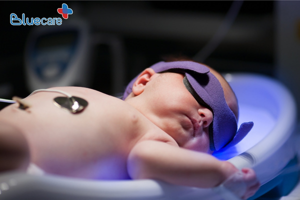 Nếu trẻ bị lệch miếng bịt mắt trong thời gian chiếu vàng da cần liên hệ với bác sĩ 