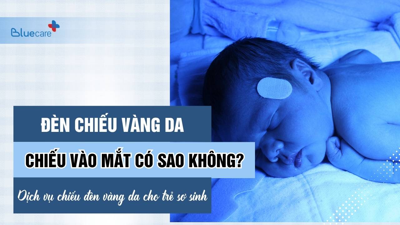 Đèn Chiếu Vàng Da Chiếu Vào Mắt Có Sao Không? Bố Mẹ Nên Biết