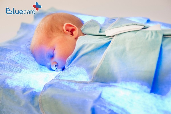 Cần chiếu đèn vàng da theo chỉ định của bác sĩ