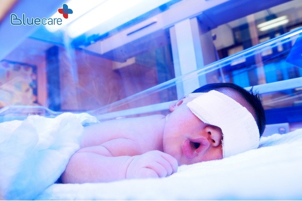 Chiếu đèn vàng da có ảnh hưởng đến thị lực sau này nếu không được chiếu đúng cách 