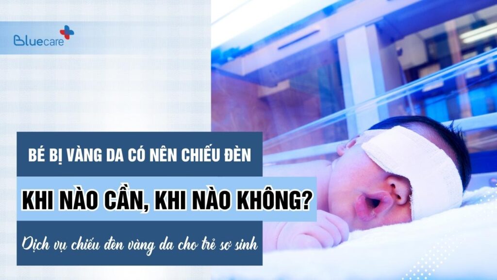 Bé Bị Vàng Da Có Nên Chiếu Đèn: Khi Nào Cần, Khi Nào Không
