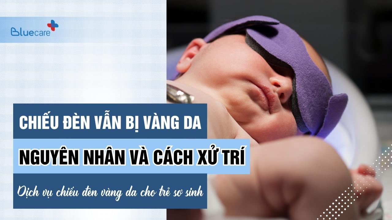 Chiếu Đèn Vẫn Bị Vàng Da: Nguyên Nhân Và Cách Xử Trí