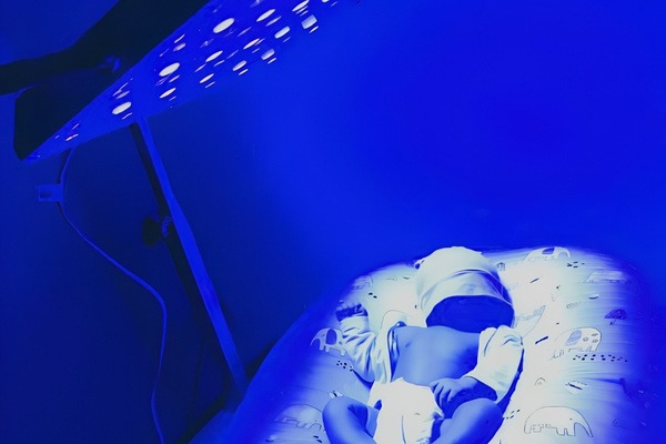 Đèn chiếu vàng da 1 mặt