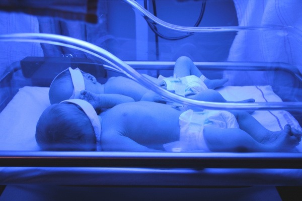Chiếu đèn vàng da cho trẻ tại viện