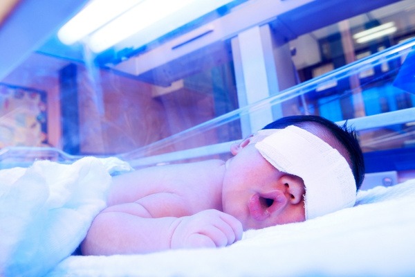 Khoảng cách có ảnh hưởng đến hiệu quả chiếu đèn vàng da