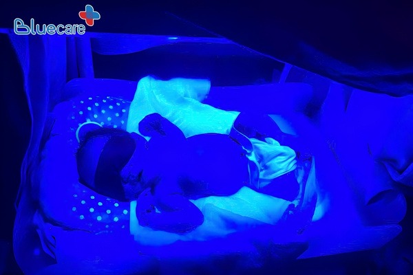 Khoảng cách chiếu đèn vàng da cho trẻ sơ sinh thường khoảng 30-50 cm