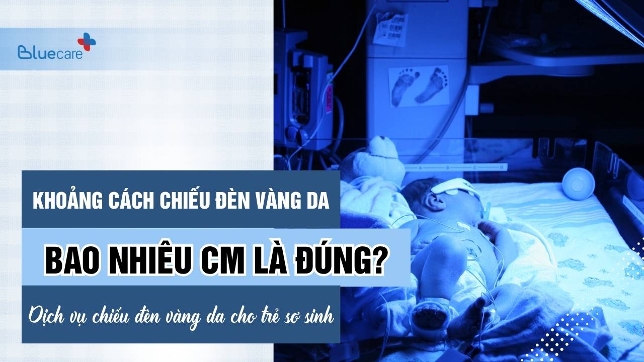 Khoảng Cách Chiếu Đèn Vàng Da Cho Trẻ Sơ Sinh Là Bao Nhiêu?